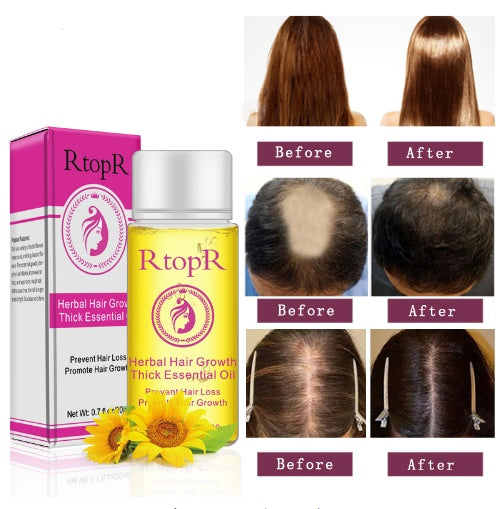 Fast Powerful Hair Growth Products Essential Oil Liquid Treatment Preventing Hair Loss Hair Care 20ml Fast Powerful Hair Growth Products Essential Oil Liquid Treatment Preventing Hair Loss Hair Care 20ml